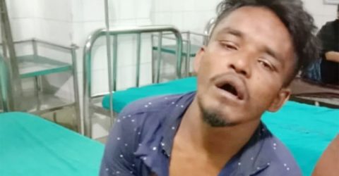 স্বর্ণের চেইন গিলে ফেললো ছিনতাইকারী