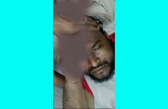 বরিশালে গভীর রাতে যুবদল নেতাকে কুপিয়ে জখম