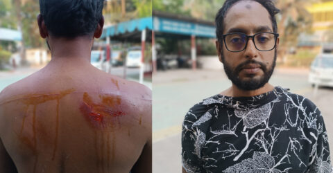 বরিশালে বিএনপির ১৩ নং ওয়ার্ড এর সাবেক ছাত্রদল সভাপতি ও যুগ্ন আহবায়ক এর উপর হামলা