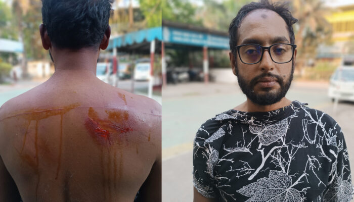 বরিশালে বিএনপির ১৩ নং ওয়ার্ড এর সাবেক ছাত্রদল সভাপতি ও যুগ্ন আহবায়ক এর উপর হামলা