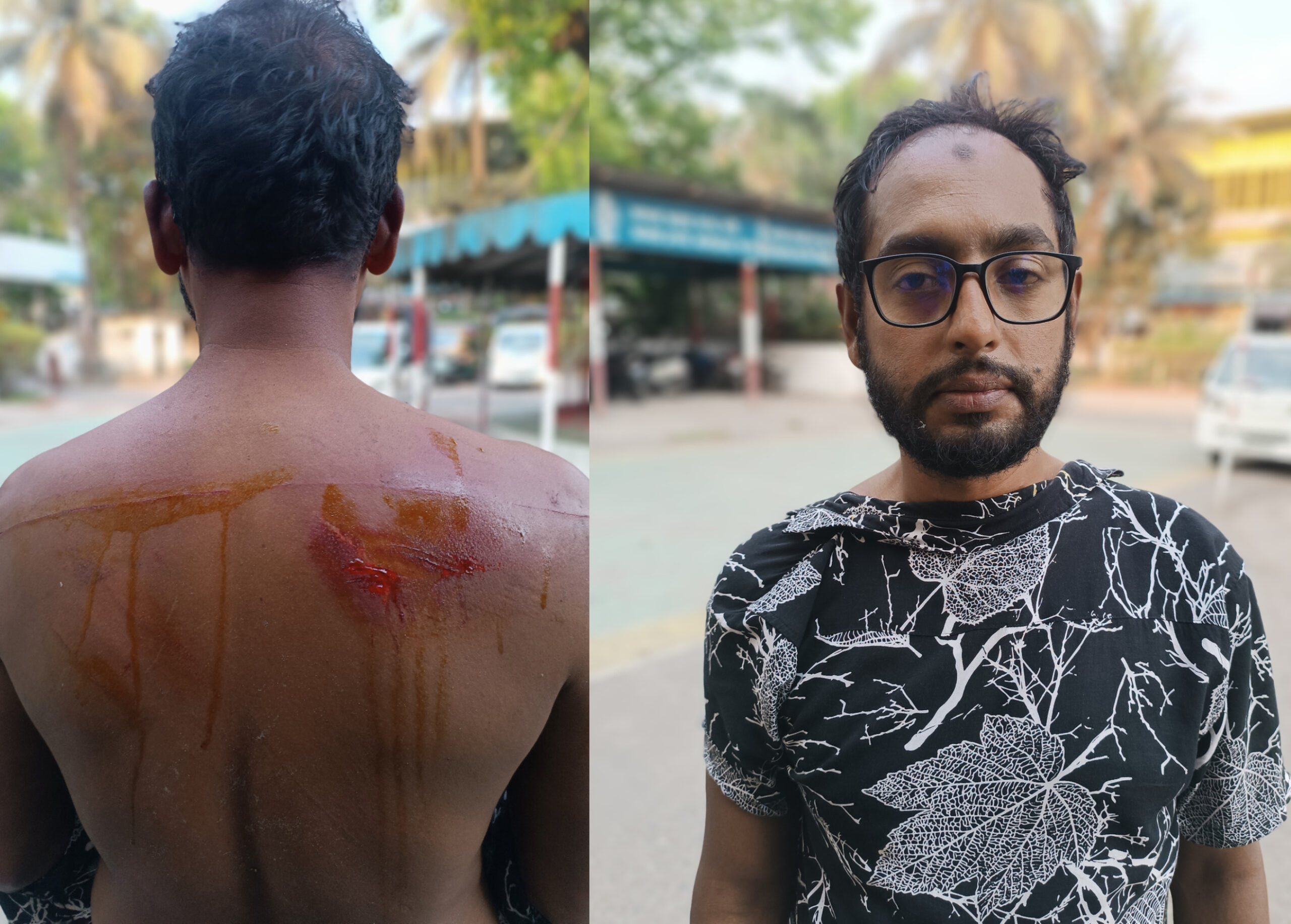 বরিশালে বিএনপির ১৩ নং ওয়ার্ড এর সাবেক ছাত্রদল সভাপতি ও যুগ্ন আহবায়ক এর উপর হামলা